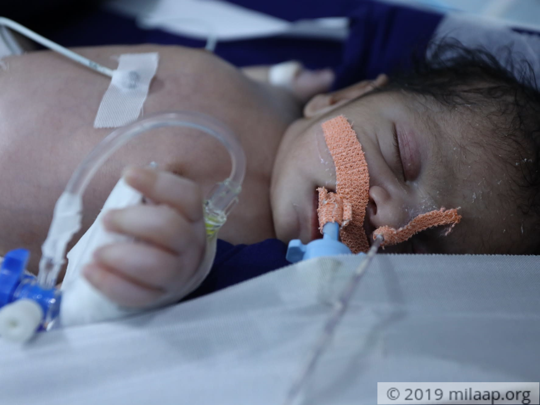 This Baby's Lungs Are Bleeding, Without Urgent Treatment He Might Not