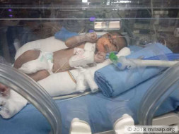 Help Baby Of Nazmeen Khan Who Is Under ICU