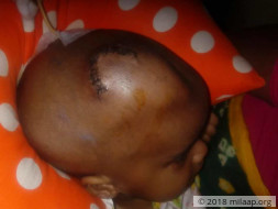 Baby Arohi is suffering from a severe brain condition and needs help
