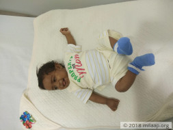 This 4 month old baby needs a liver transplant to survive