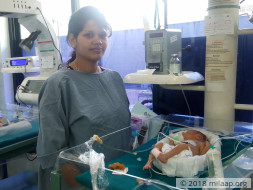 12 Days Old, These Twins Are Fighting Hard To Make It In This World