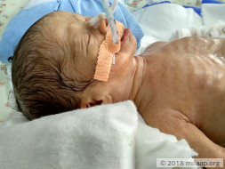 Help Priya save her premature twins