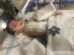 This 3-month-old baby needs an urgent heart surgery to survive
