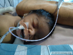 This baby is in a critical state and needs our help to live