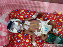 They Begged To Save Their Baby, But It Isn’t Enough To Save Her