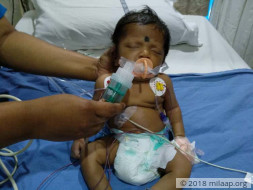 This one-month-old baby needs a heart surgery to survive