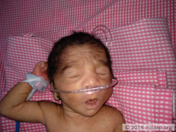 People Refused To Help In Saving This Child Because She Is A Girl