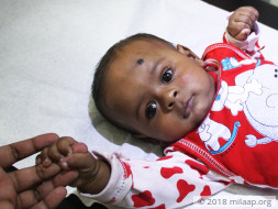 This 6-Month-Old Baby's Oxygen Levels Are Dipping Dangerously Low