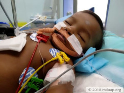 6-month-old’s Fever Escalated Into Liver Damage In Hours