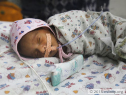 15-day-old Baby Has Only 6 Days To Get A Heart Surgery And Survive