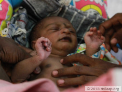 Farmers Have Only 1 Week Left To Save Baby With Multiple Heart Defects