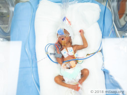 Help this first-time parents save their premature baby boy