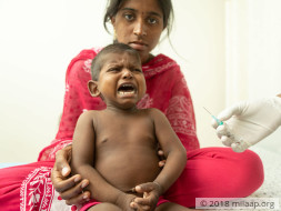 2-year-old Will Scratch Himself To Death Without Liver Transplant