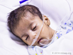 Mother Cannot Afford To Save 2-month-old Whose Own Saliva Chokes Lungs