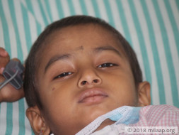 4-year-old Is In Constant Pain Due To A Dreadful Cancer