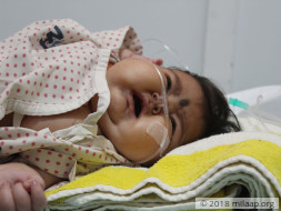 Help 5 months old Sanjana to get a Bone Marrow Transplant