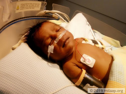 This 1-month-old's Heart Will Stop Beating Without An Urgent Surgery
