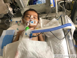 6 month old Baby Kirti needs an urgent heart surgery to breathe again