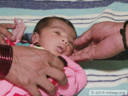 15 days old Baby of Durga needs an open heart surgery to survive.
