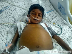 8-year-old Pawan Needs A Liver Transplant In Five Days To Live