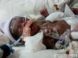 This 1-Month-Old Is Fighting For His Life In The ICU