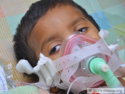 These Parents Are Skipping Meals To Save Money For Their Son's Life