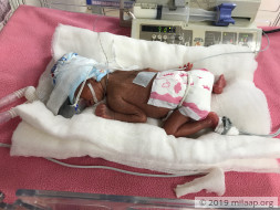 Help Shamika and Amogh's prematurely born baby recover soon