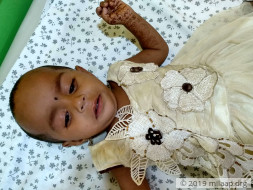 This Baby Has A Rare Birth Defect That Is Killing Her From Inside