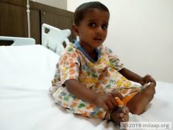 This 2-year-old baby girl needs a heart surgery to survive