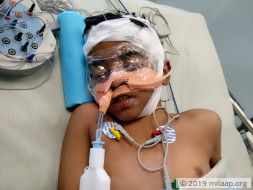 8-year-old Nihit is in a critical condition in the ICU and needs help
