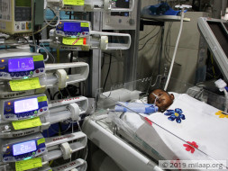 Her Oxygen Level Is Rapidly Dropping, This Baby Needs A Surgery Today