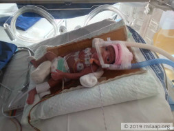 This 1/2kg Baby Girl Is A Fighter Who Is Beating Odds To Survive