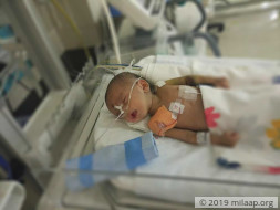 Help 3-month-old Manak fight heart disease