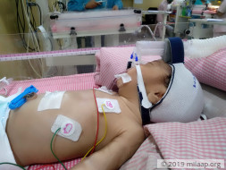 With A Mentally Ill Husband This Mother Is Struggling To Save Her Baby