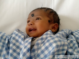 Save This 2-month-old Baby Who Has 2 Large Holes In Her Heart