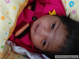Baby Born Without Major Valve In Heart Is Gasping For Every Breath