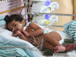 10-Month-Old Baby Girl Will Lose Her Limbs And Life To Gangrene