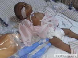 1-Year-Old Baby Girl Needs An Urgent Liver Transplant To Survive