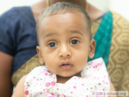 A Deadly Bone Infection Will Cripple And Kill This 1-year-old Baby