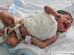 An Aggressive Flesh-Eating Disease Will Kill This 1-Month-Old Baby