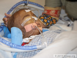 Help 1-Year-Old Arush beat Pneumonia and come out of the ICU alive