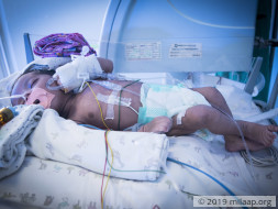 1-Month-Old Baby Who Struggles For Every Breath Needs Urgent Help
