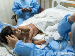 3-Year-Old Suffers From Severe Burns After Falling Into Boiling Water