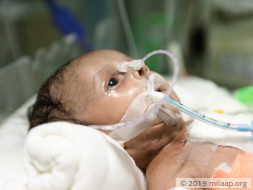 Sraveena's baby is in a critical state and needs urgent help