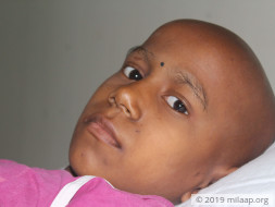 Cancer Has Taken Away This 10-Year-Old's Hair, But Not Her Spirit