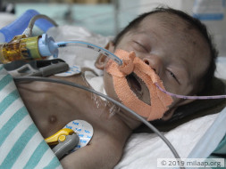 Labourer Will Lose Baby Girl To Multiple Organ Failure Without Help