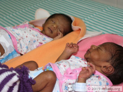 Even Their Parents’ Touch Can Be Fatal For These 15-Day-Old Twins