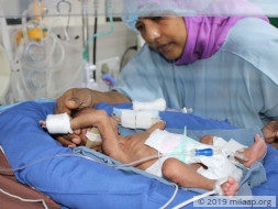 Sabir unnisa needs your support to save her baby