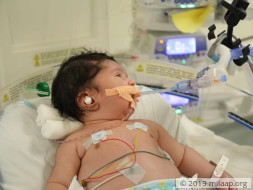 Orphanage Teacher Struggles To Save 10-Day-Old Who Cannot Eat