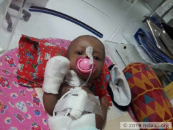 4-months old Baby of Nancy needs your support to undergo his treatment